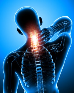 Oakville Physio clinic showing neck pain, to help pain relief and increase function