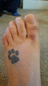 Turf toe injury at Oakville, Milton foot clinic
