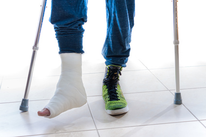 Patient walking with ankle, foot cast and using crutches, at North Oakville Physio for broken bone, fracture, following initial injury