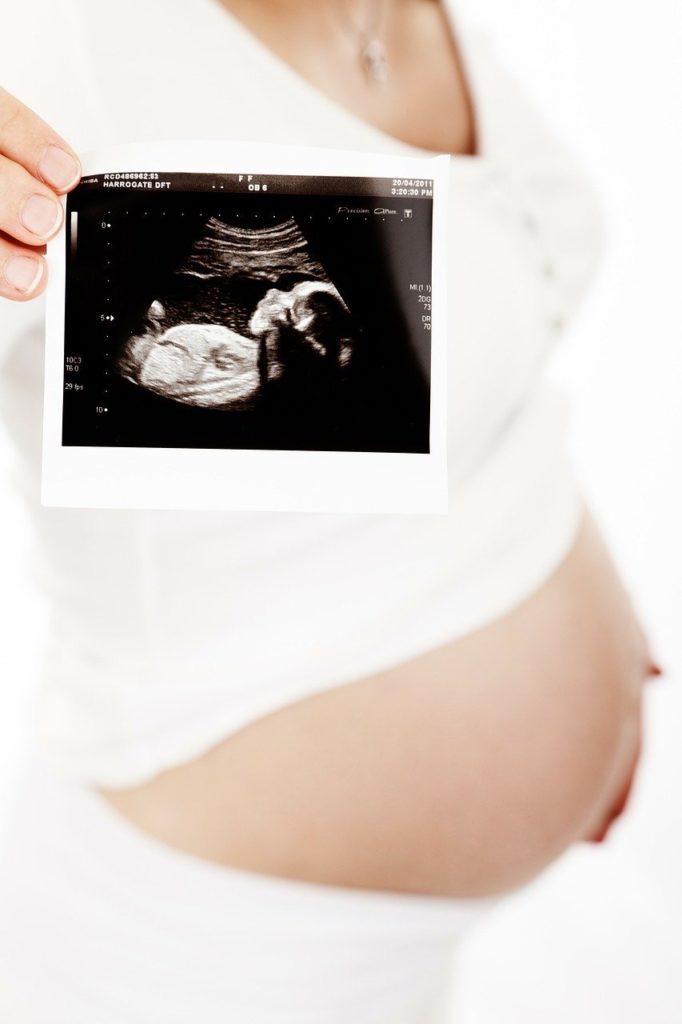 Fetal ultrasound picture, in blog discussion different types of imaging, their uses, and when imaging does more harm than good.